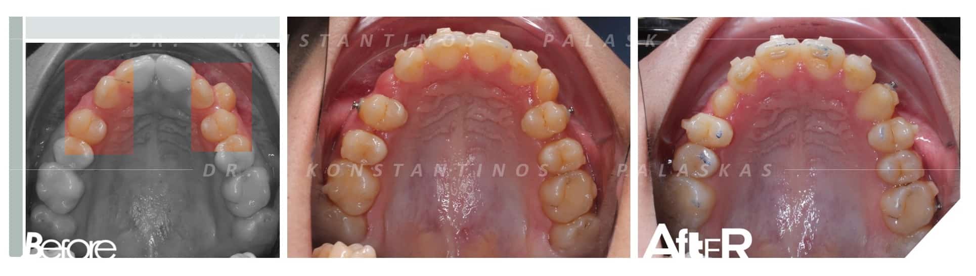 CASO 1 CELESTE CANINOS