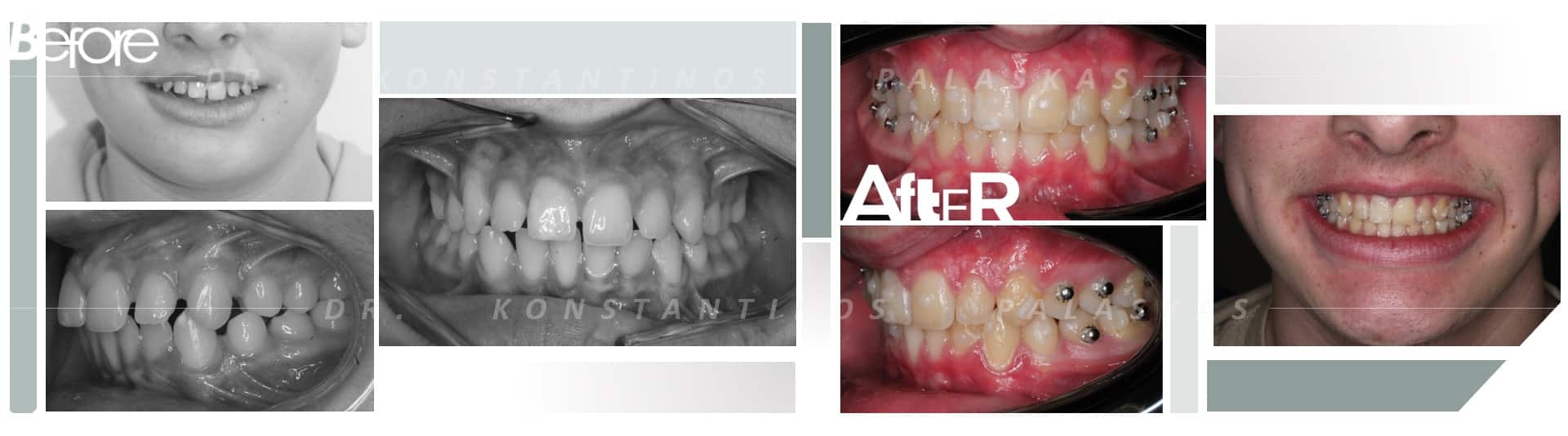 CASO 1 ESPACIOS GUILLERMO (TODAVIA FALTAN LAS FOTOS FINALES ESTARA LISTO EL MES DE JULIO PRINCIPIOS)