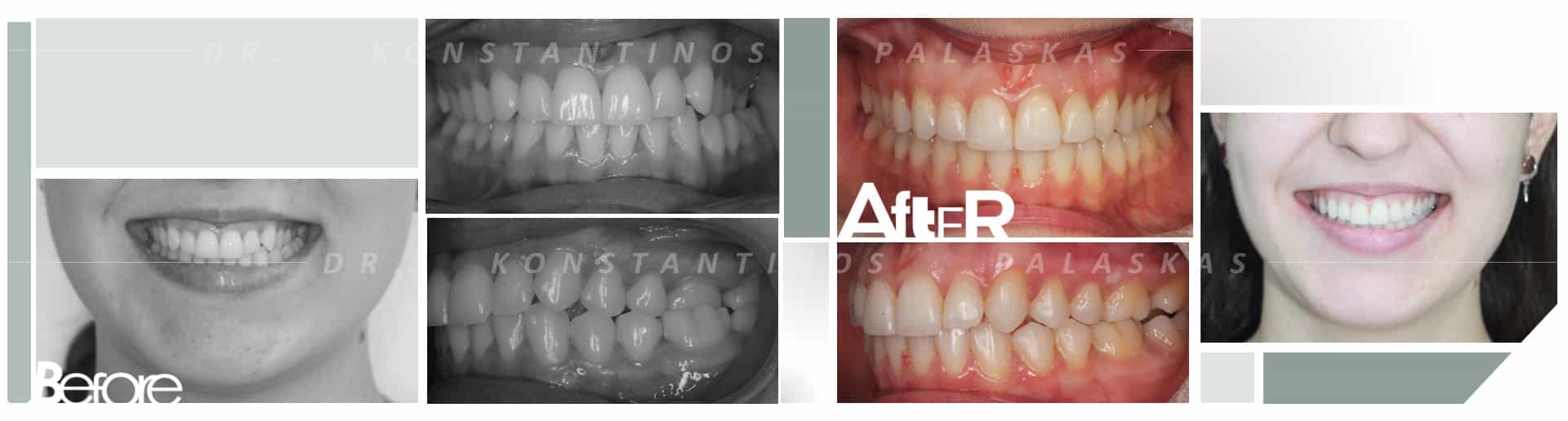 CASO 1 MINERVA CRUZADA