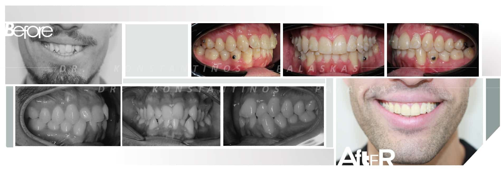 CASO 1 christian clase III