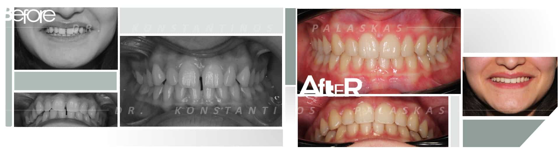 CASO 2 ESPACIOS CLARA