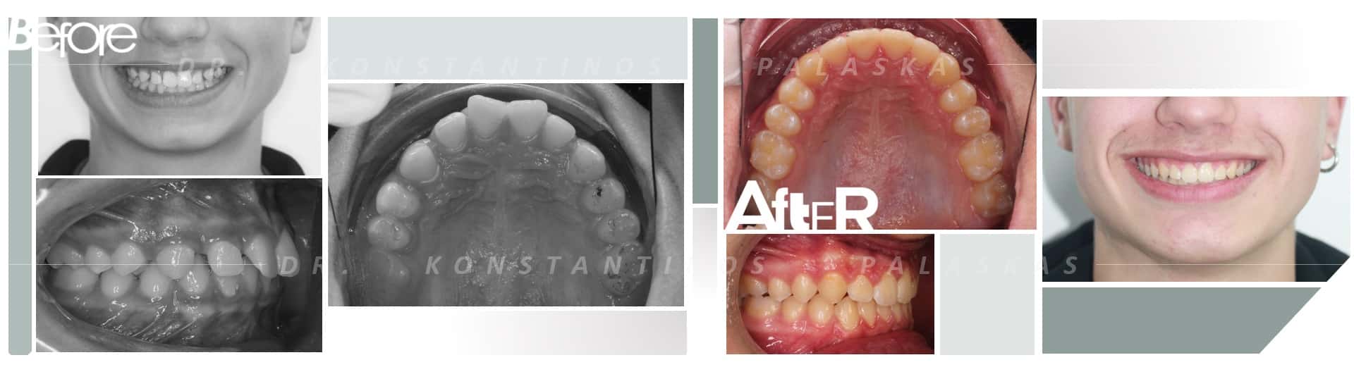 CASO 3 ESPACIOS YOEL