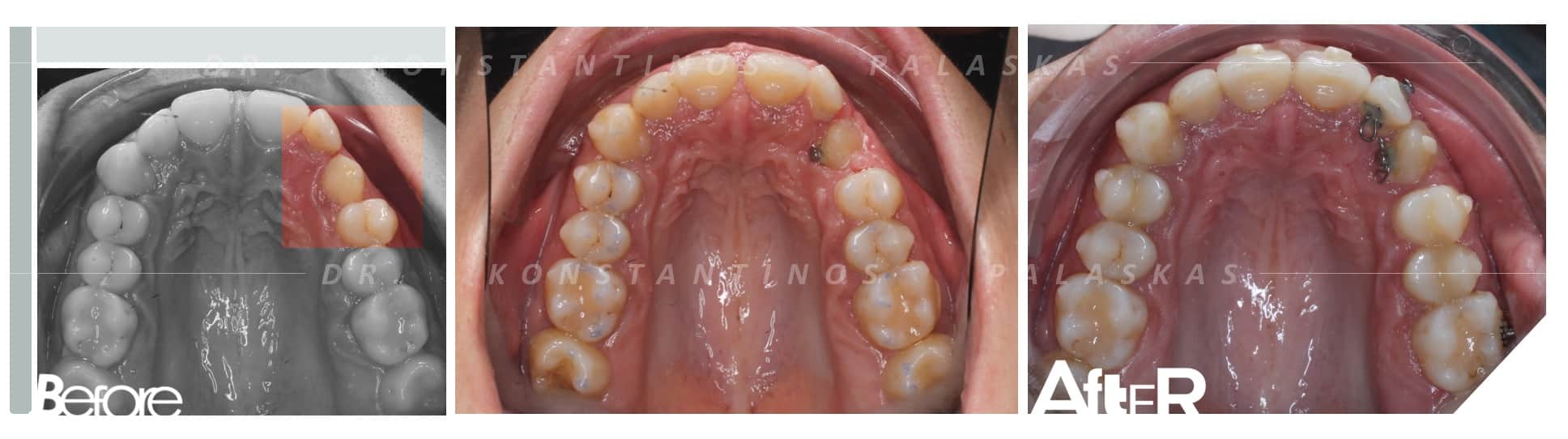 CASO 3 JENNIFER CANINO