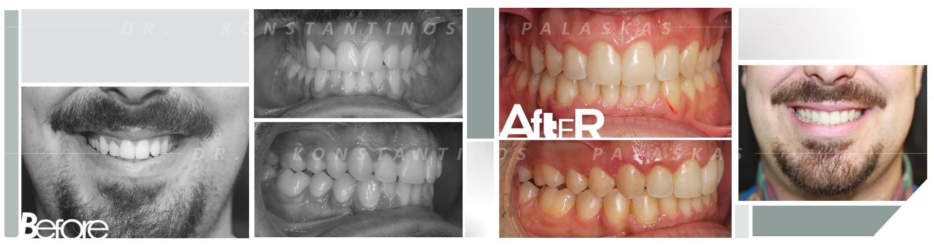 CASO 4 CRUZADA FELIX