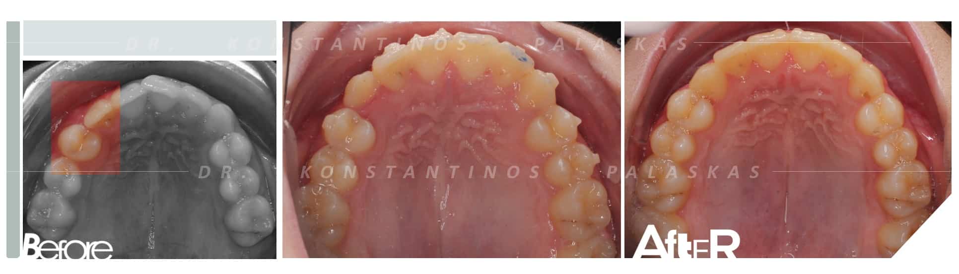 CASO 4 MARCOS CANINO